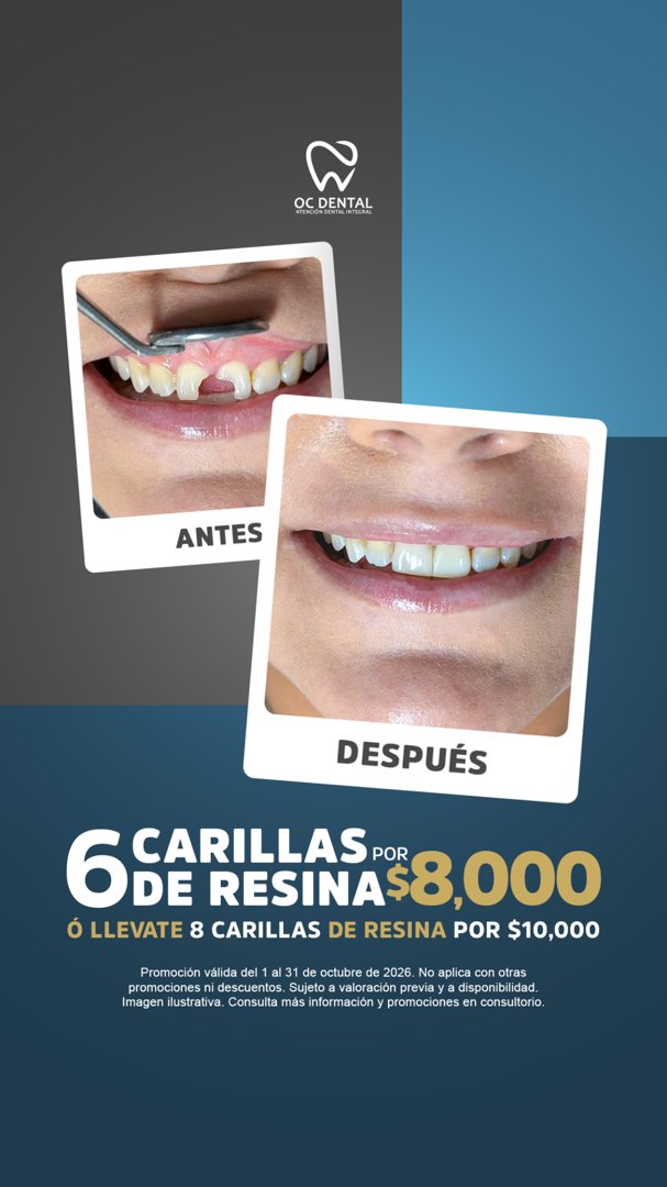 Anuncio de OC Dental Navojoa