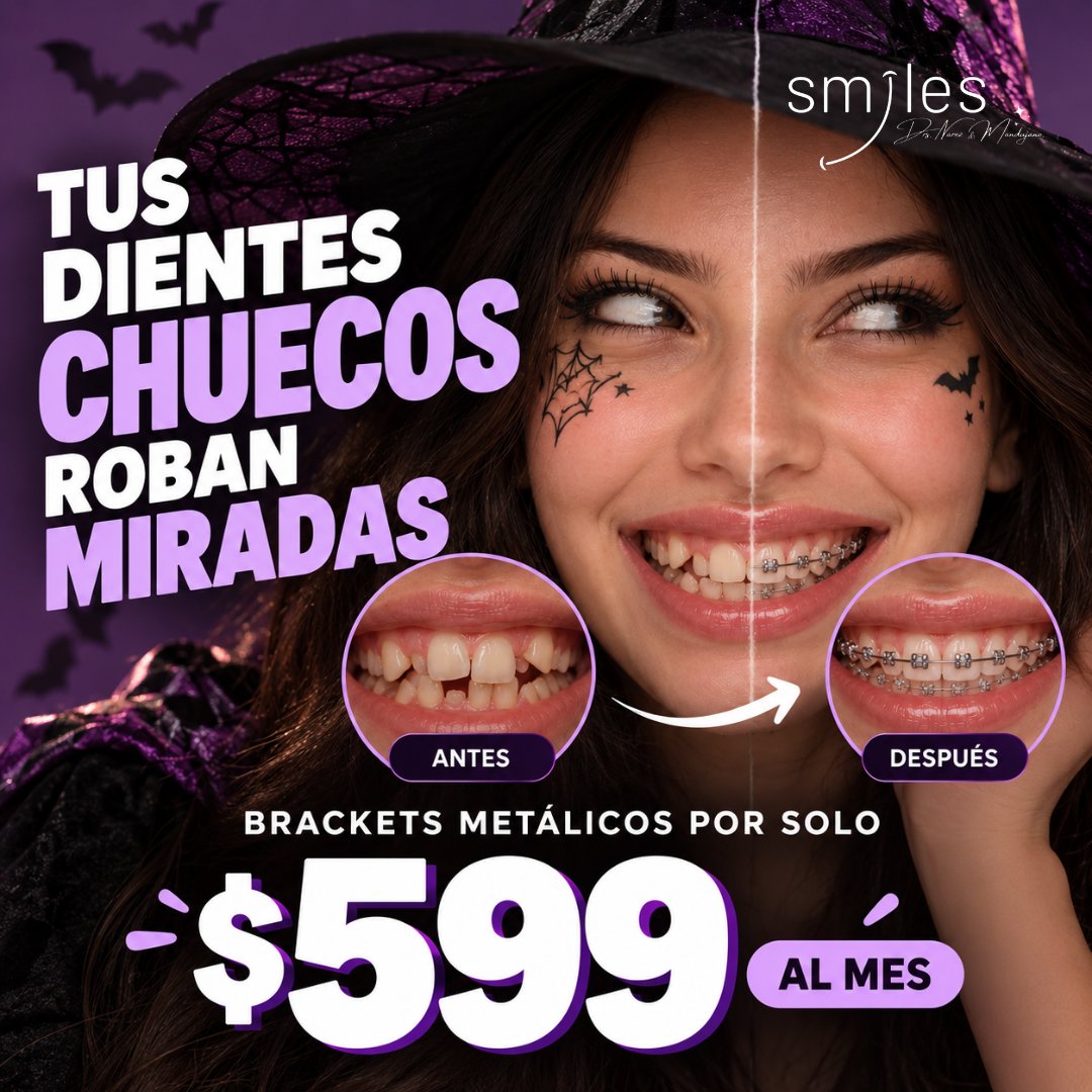 Anuncio de Smiles Drs. Narez &  Mandujano: Brackets metálicos