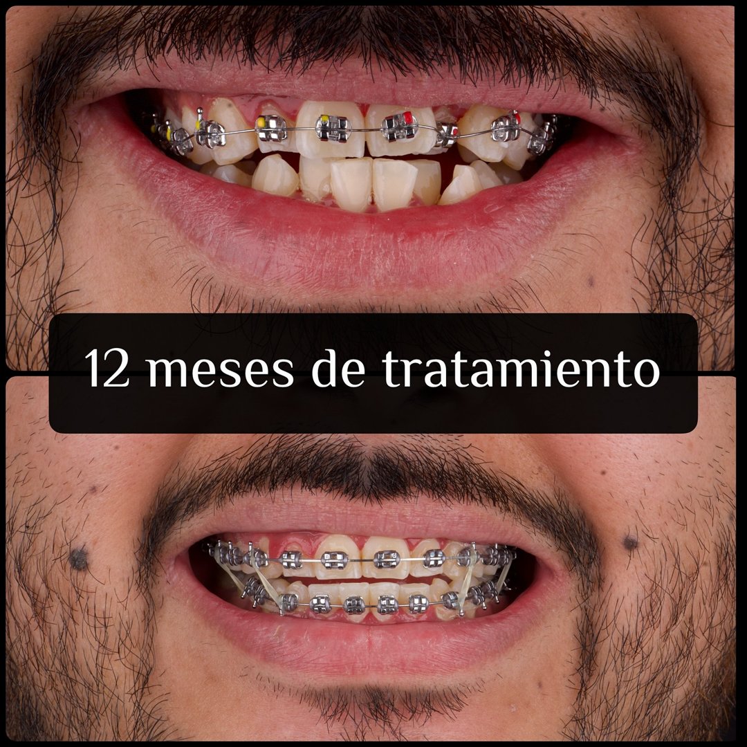 Anuncio de DentalMedic Cumbres