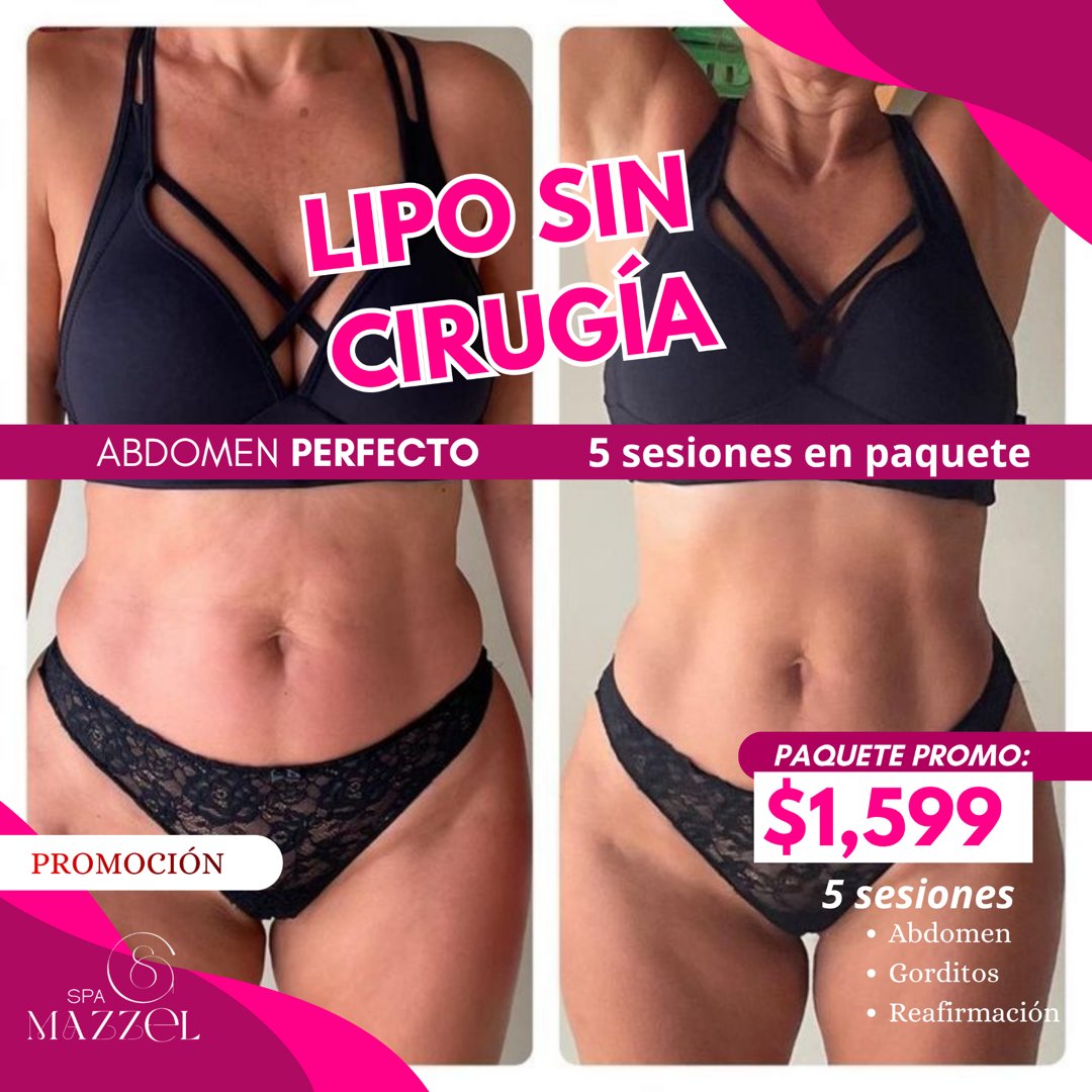 Anuncio de Spa Mazzel