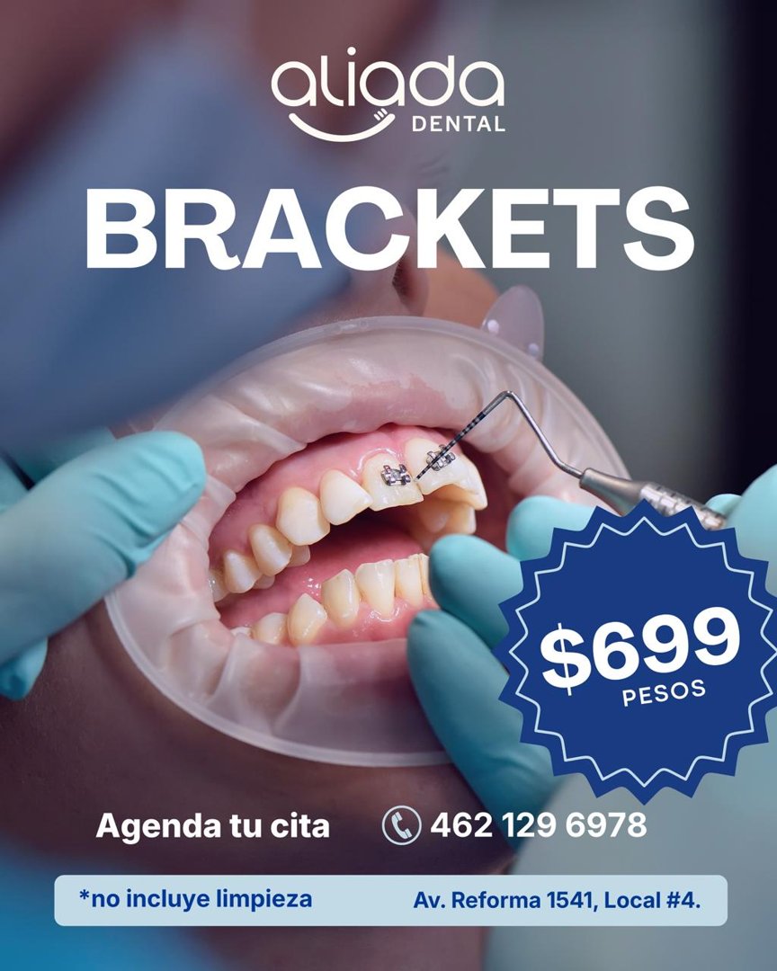 Anuncio de Aliada Dental Irapuato: brackets