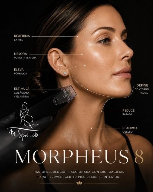 Anuncio de Mi Spacio: Morpheus 8