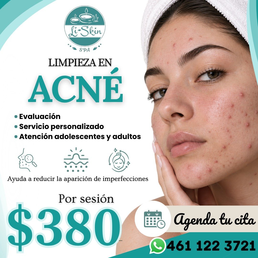 Anuncio de Li Skin Spa: Limpieza en acné