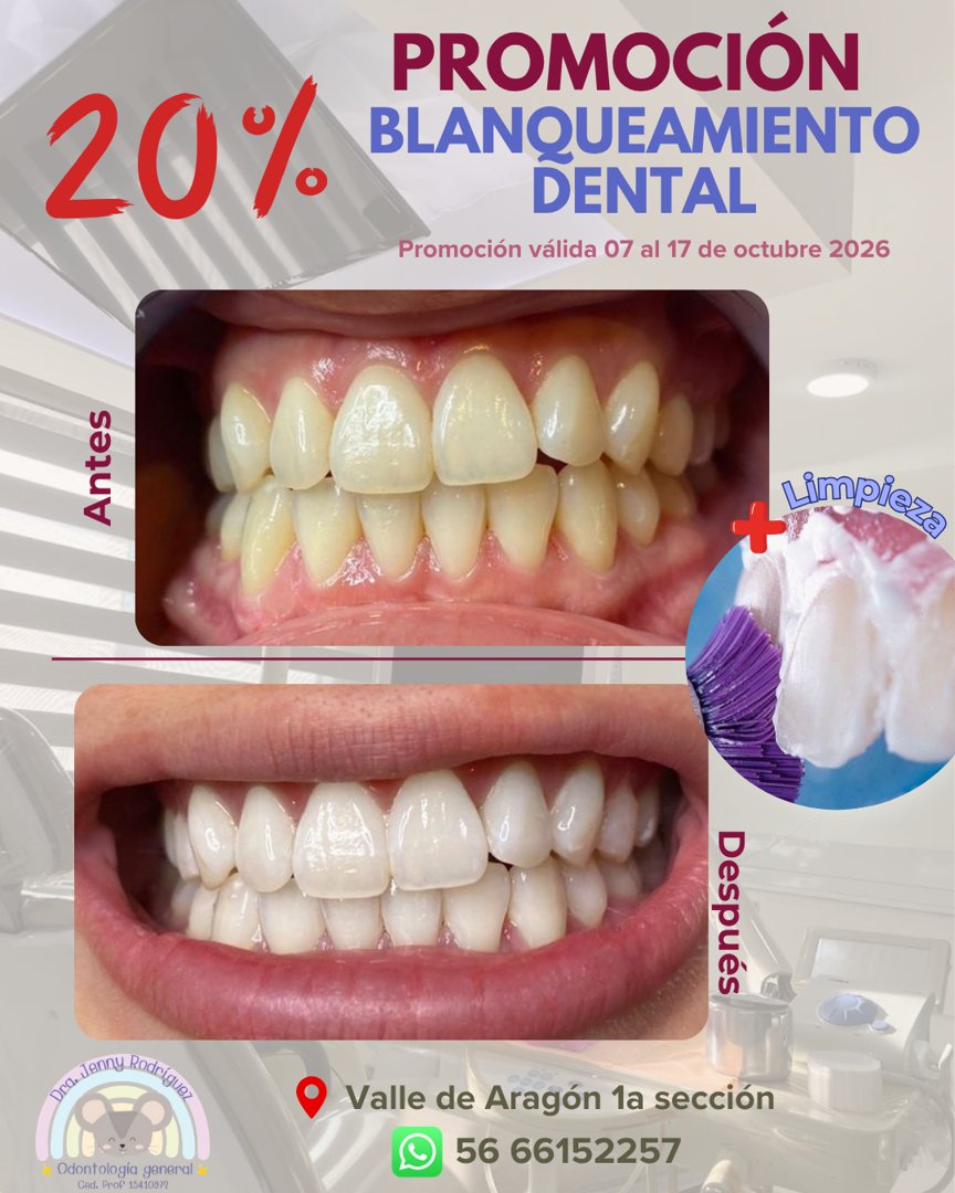Anuncio de Dra. Jenny Rodríguez: Blanqueamiento dental