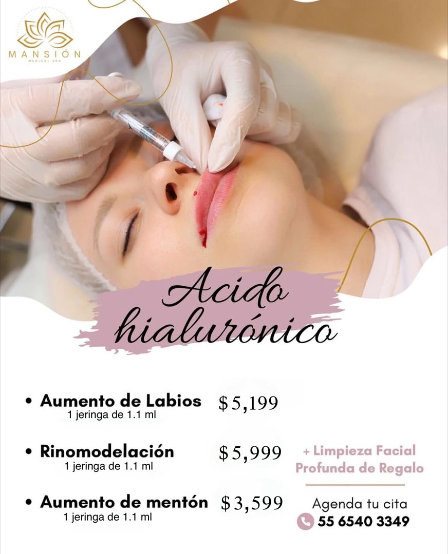 Anuncio de Mansión Medical Spa: Relleno con ácido hialurónico