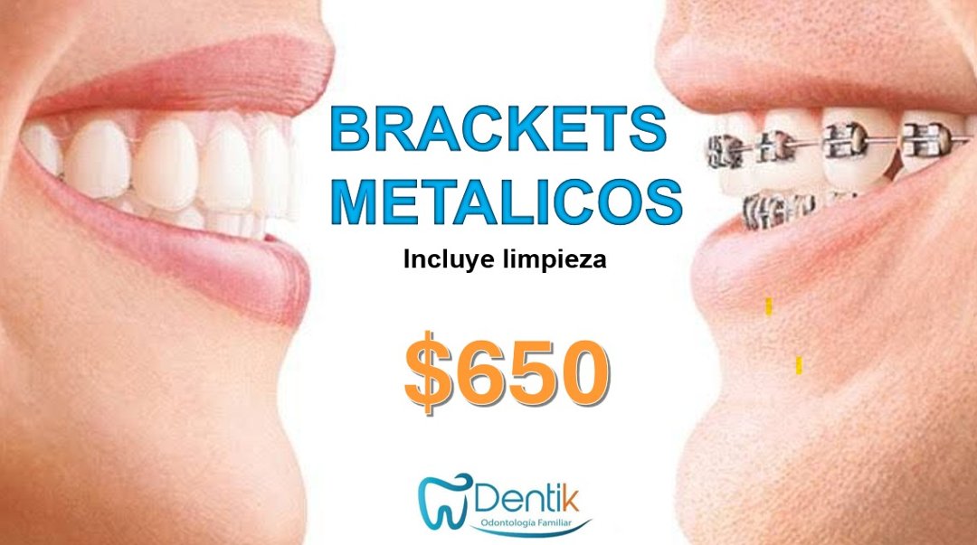Anuncio de Dentik Cuauhtémoc: Brackets metálicos
