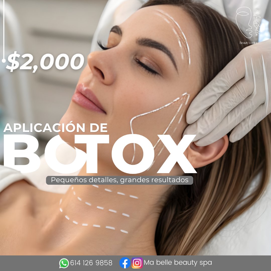Anuncio de Ma Belle Beauty Spa: Aplicación de Botox
