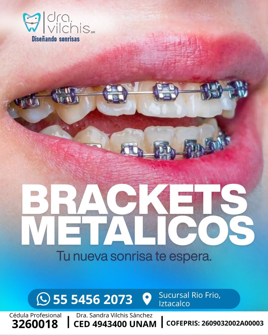 Anuncio de Iztacalco Ortodoncia Dra Vilchis: Brackets metálicos