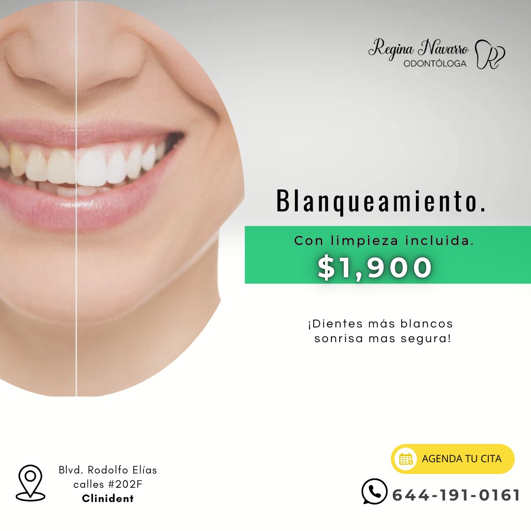 Anuncio de Dra. Regina Navarro.: Blanqueamiento dental