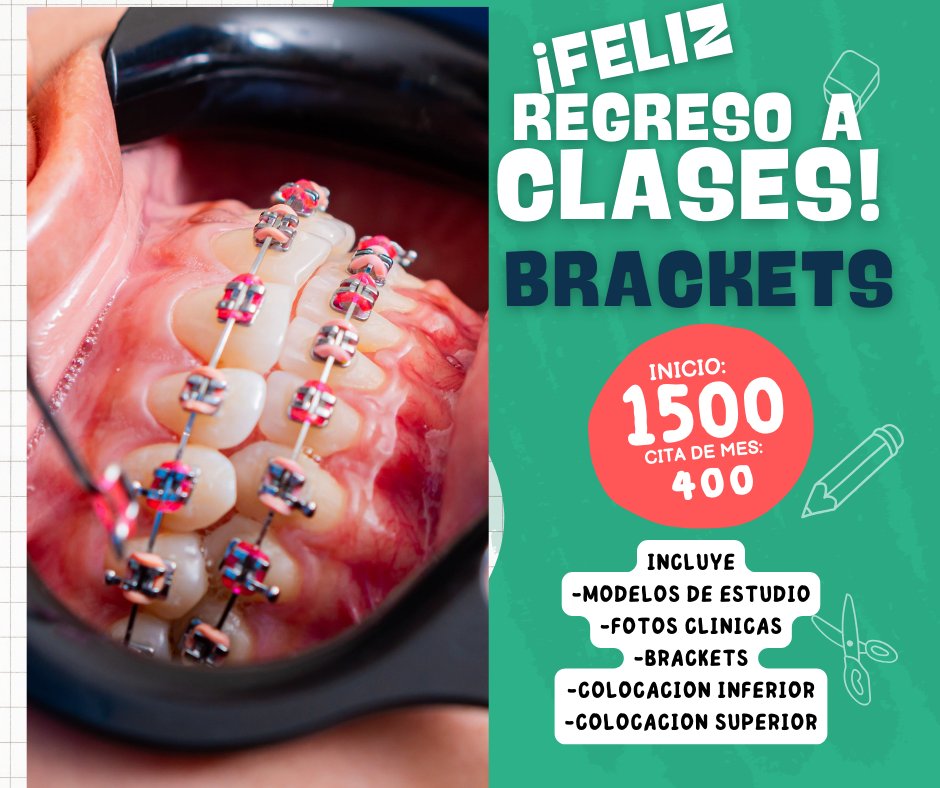 Anuncio de Odontuz: Brackets